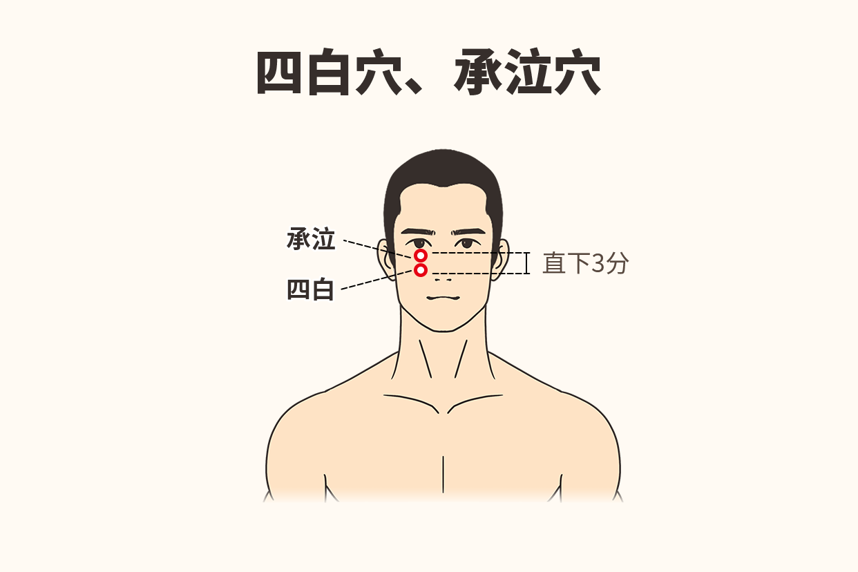 承泣四白的准确位置图