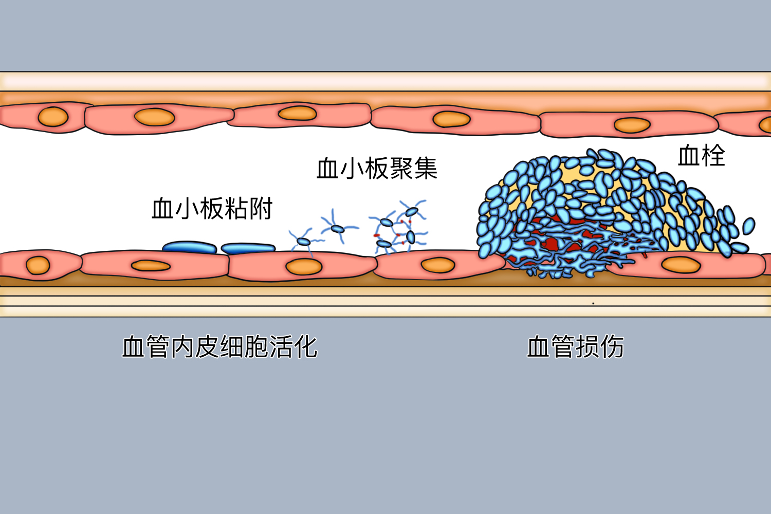 血小板聚集图片 | 百度健康·医学科普