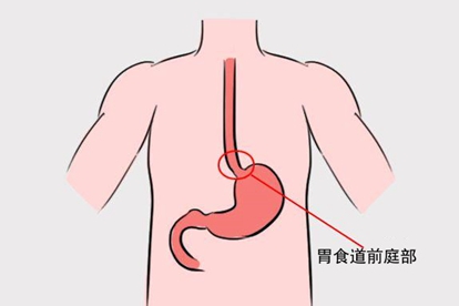 胃前庭部在哪个位置示意图 | 百度健康·医学科普
