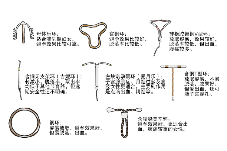 上环有几种环哪种最好 图片 | 百度健康·医学科普