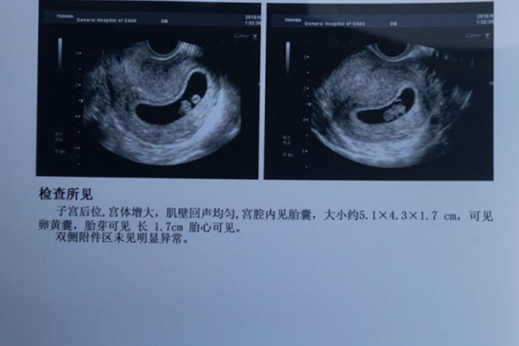 怀孕检测报告单图片 | 百度健康·医学科普