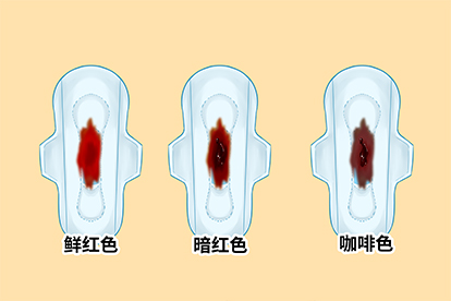 正常姨妈颜色图