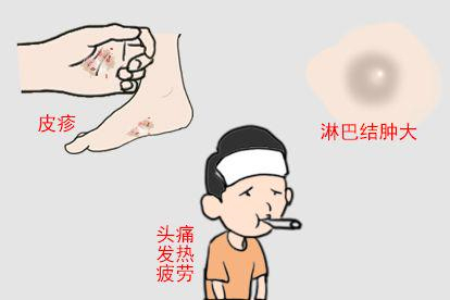 梅毒多久出现症状图片
