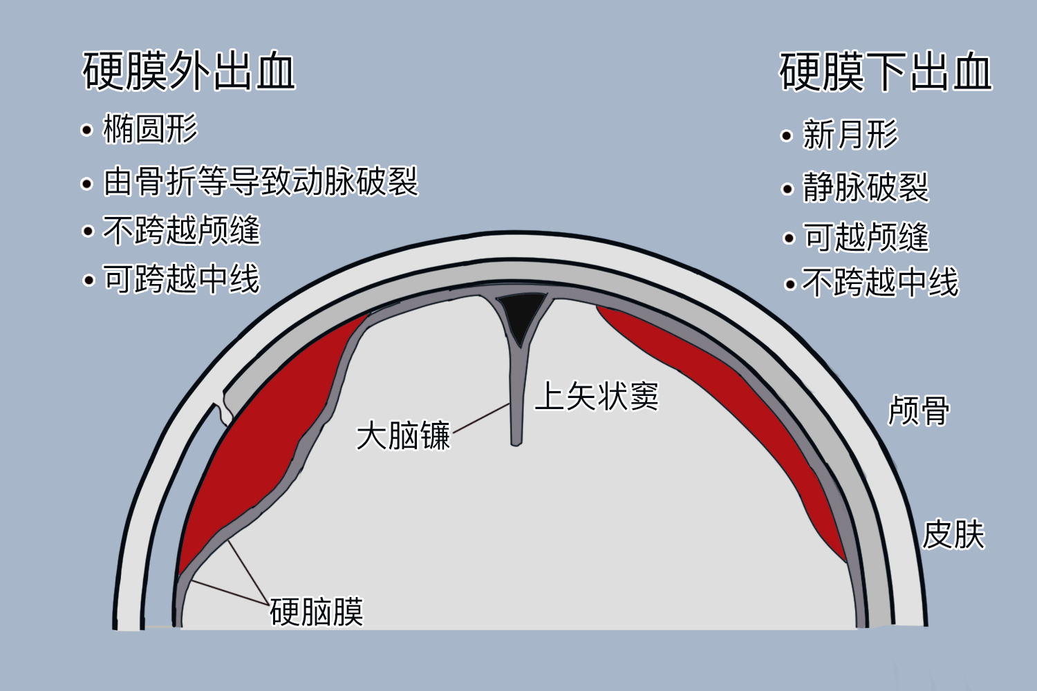 脊髓硬膜外与硬膜下区别图 | 百度健康·医学科普