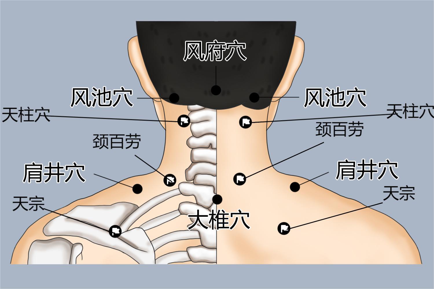 颈椎针灸图片 | 百度健康·医学科普