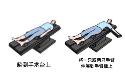 手术仰卧位摆放图片