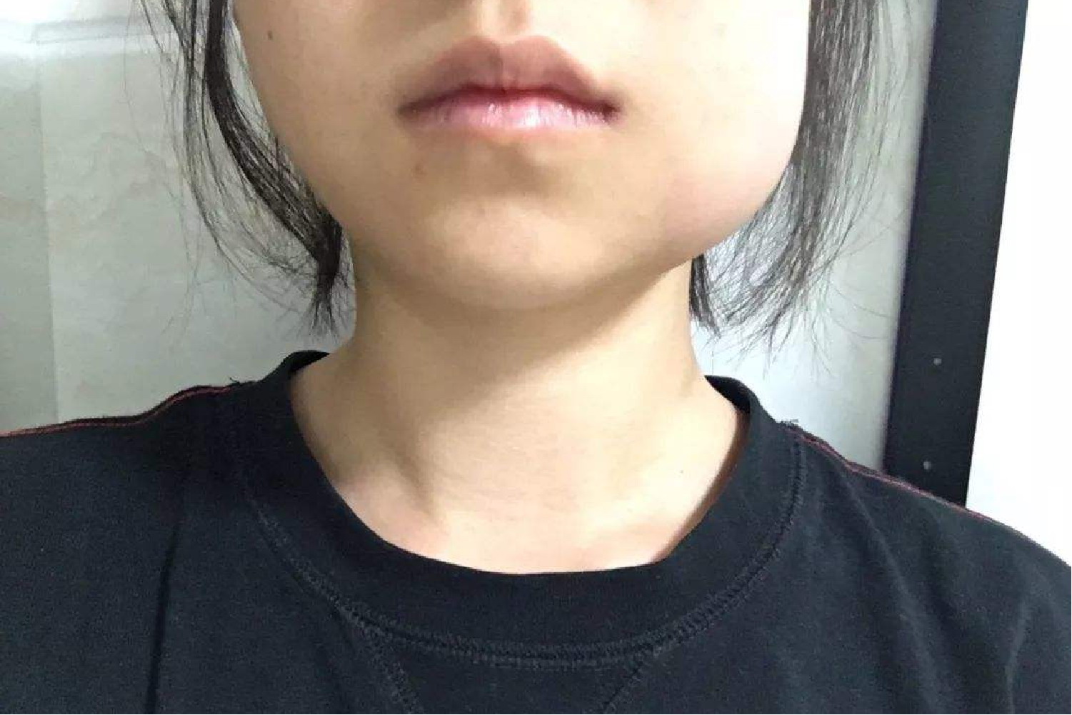 牙腮帮子肿痛图片