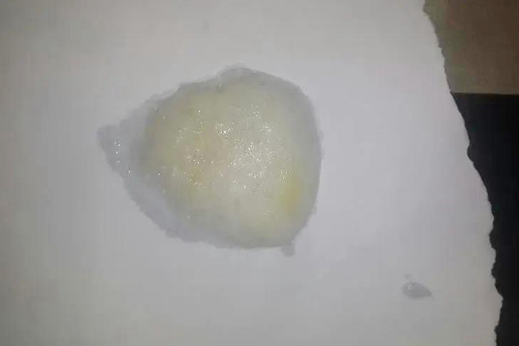 咳嗽出一坨一坨的黄痰的图片
