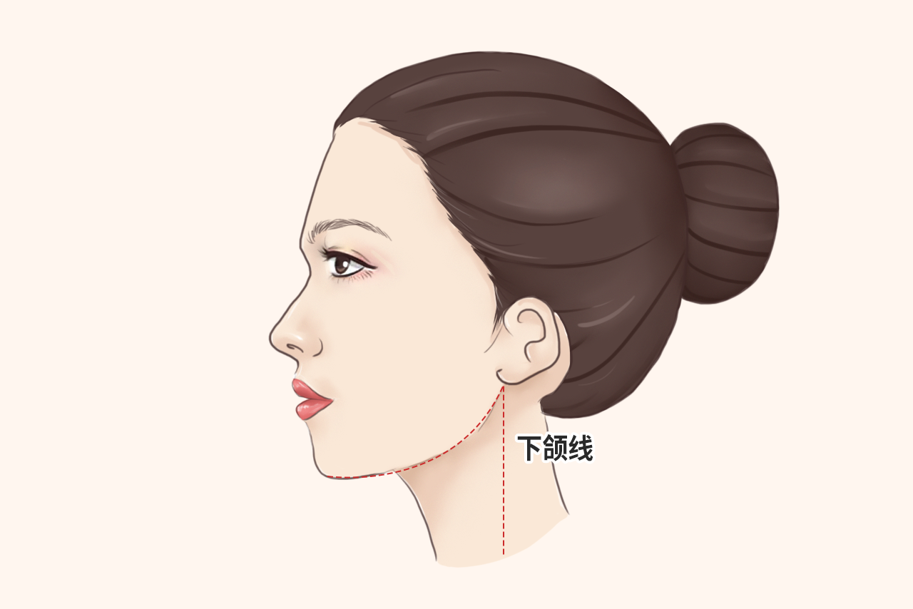 上海4月10日最划算的医美项目:8260起的假体下巴 娇俏下巴勾勒脸型-伴你美