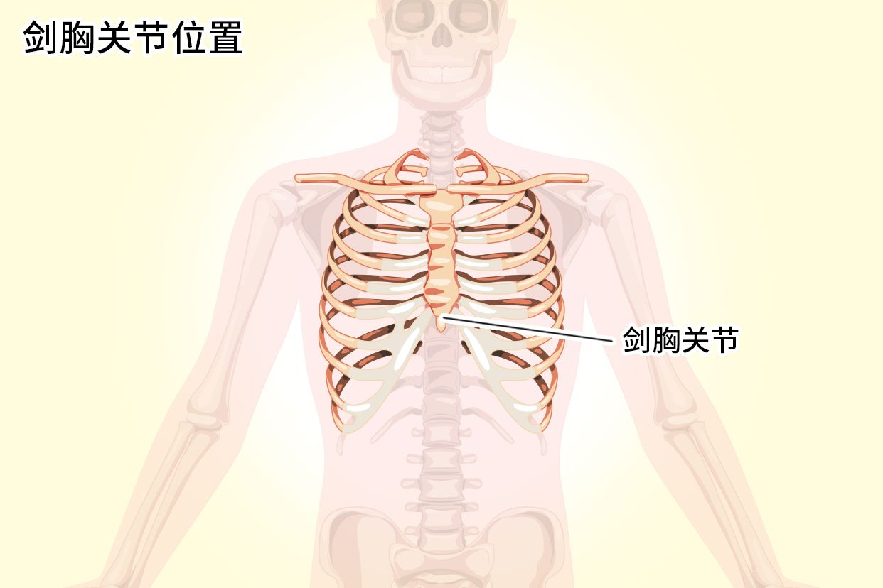 剑胸关节位置示意图