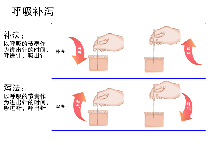 针灸补泻手法图解 | 百度健康·医学科普