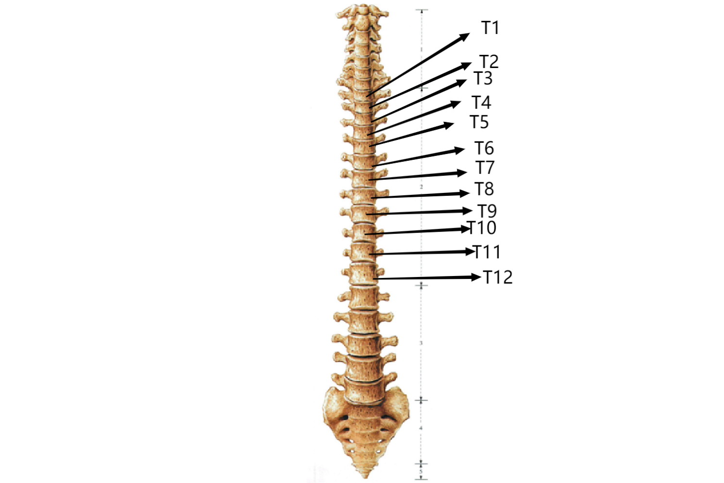 T11、T12椎体位置图