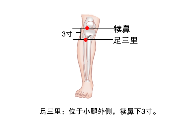 腿上扎针灸的图片