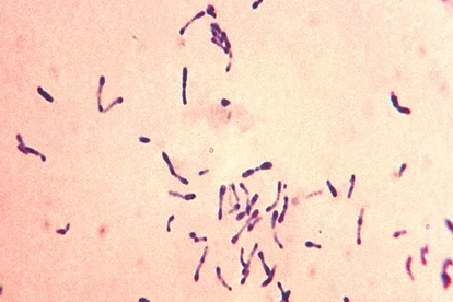 白喉杆菌显微镜下图片