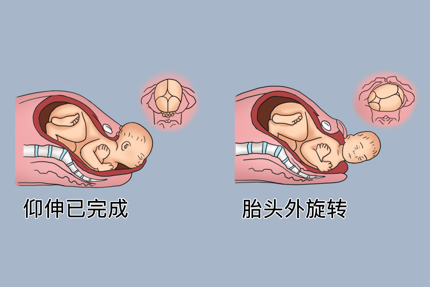 胎头下降位置图