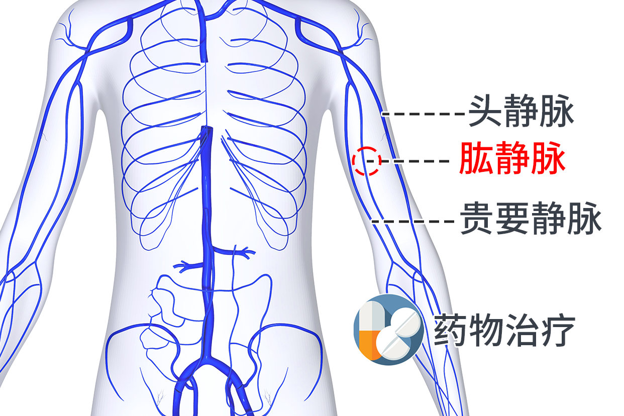 肱静脉位置图