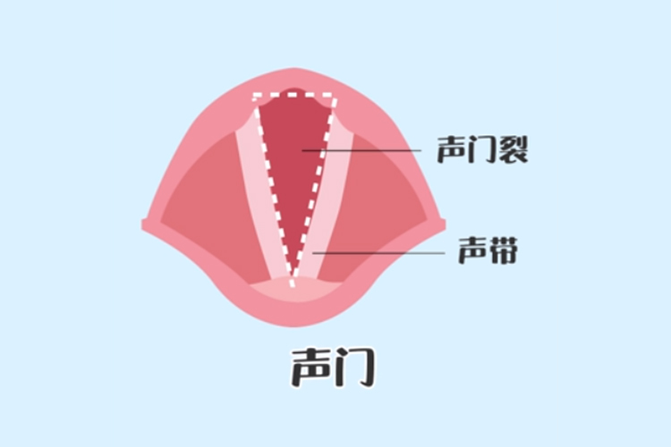 上呼吸道最狭窄的部位