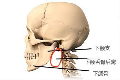 下颌舌骨后窝图片 | 百度健康·医学科普