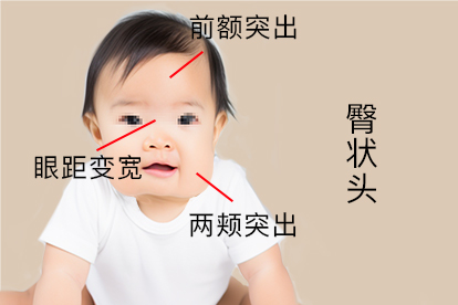 臀状头图片