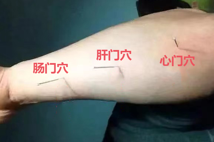 肝门肠门心门位置图 | 百度健康·医学科普