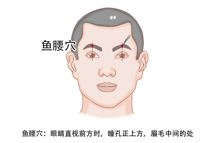 眼皮跳针灸位置和作用图