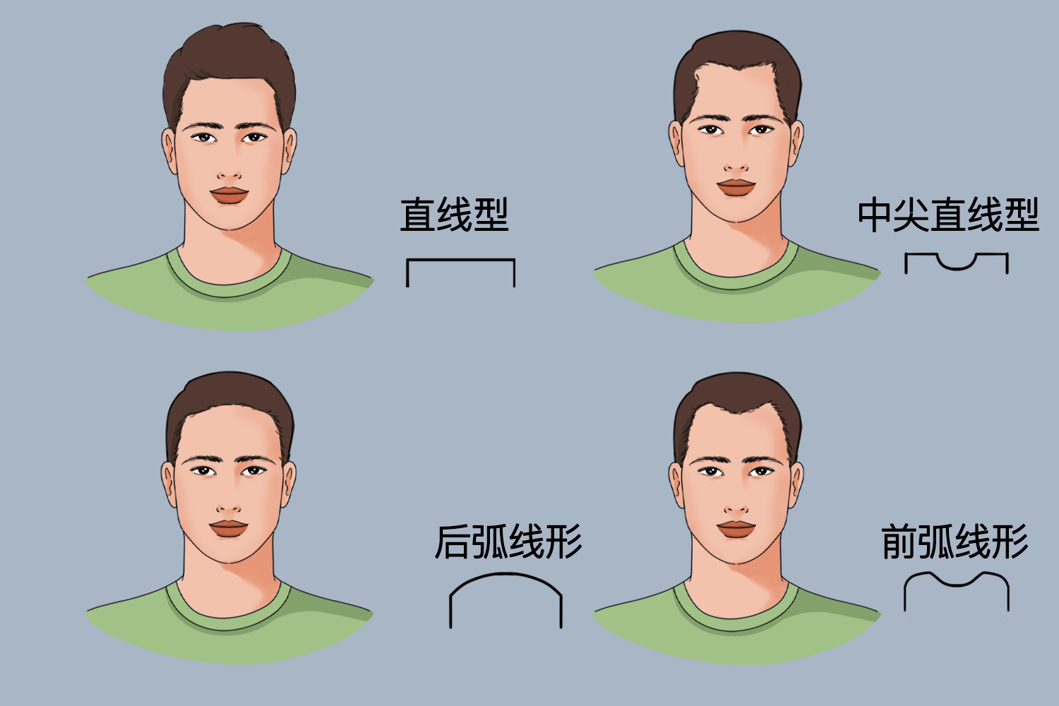 正常额角发际线图