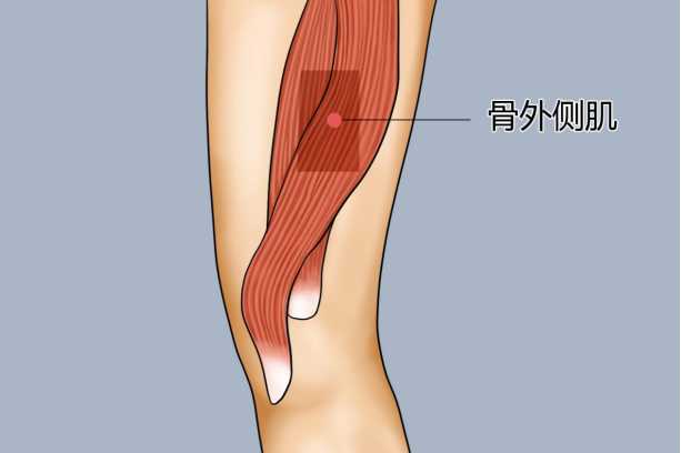 股外侧肌注射定位图