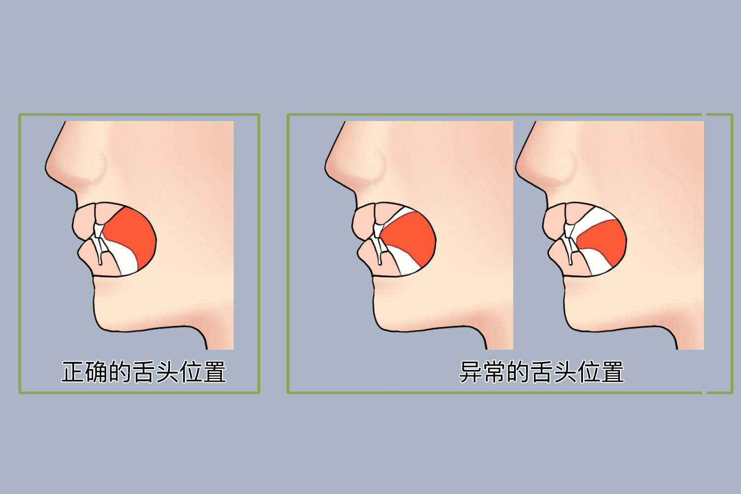 舌头应该放在口腔哪个位置