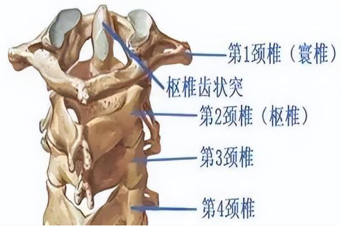 枢椎齿状突图片