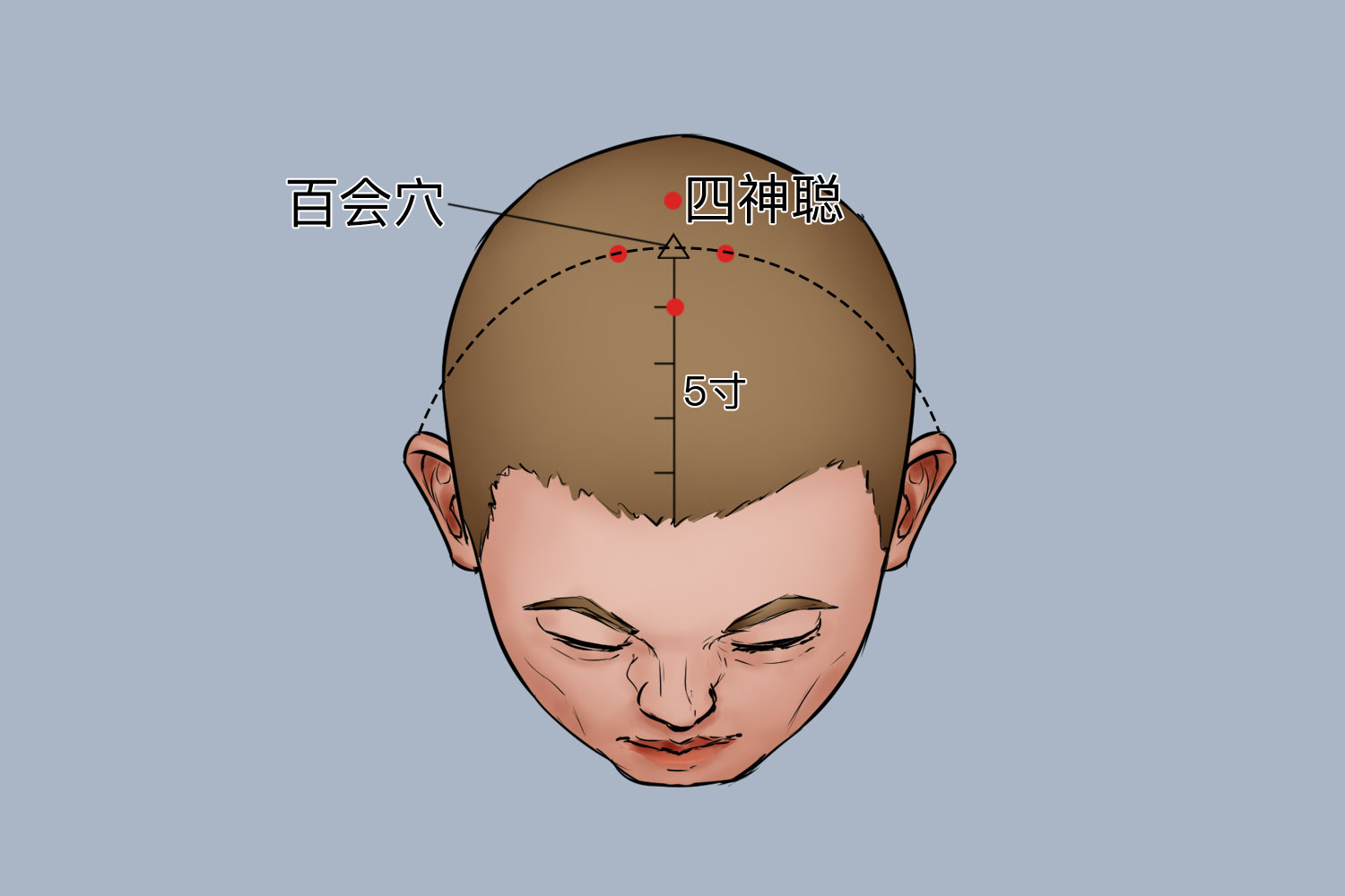 四神聪位置及作用 | 百度健康·医学科普
