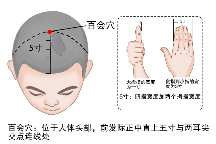 扁桃体刮痧位置示意图