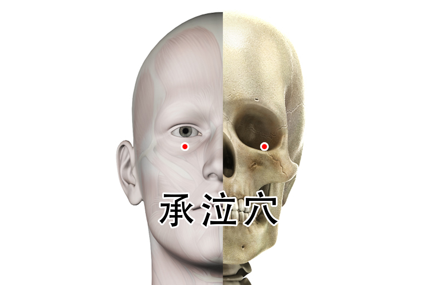 承泣的准确位置图片作用 | 百度健康·医学科普