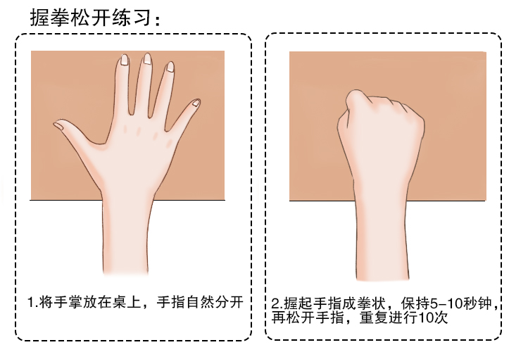 介入术后手指操图片