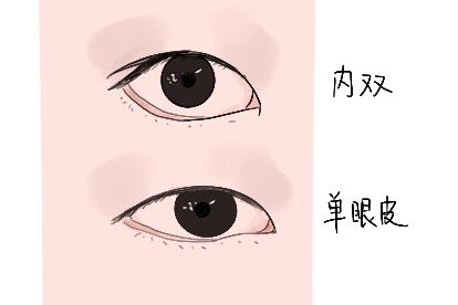 内双与单眼皮区别图