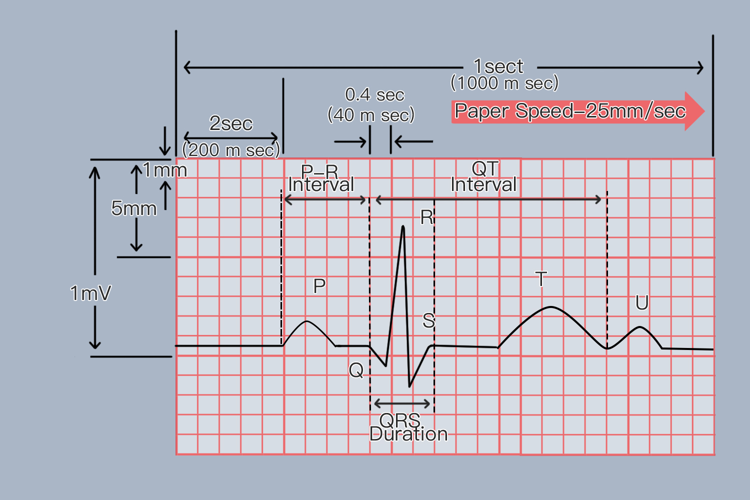 心电图正常值范围 | 百度健康·医学科普