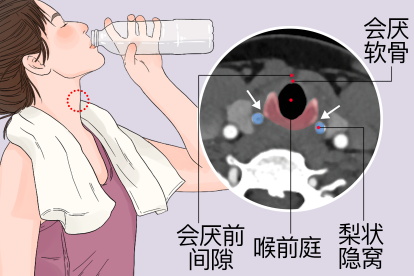 环状软骨CT解剖图