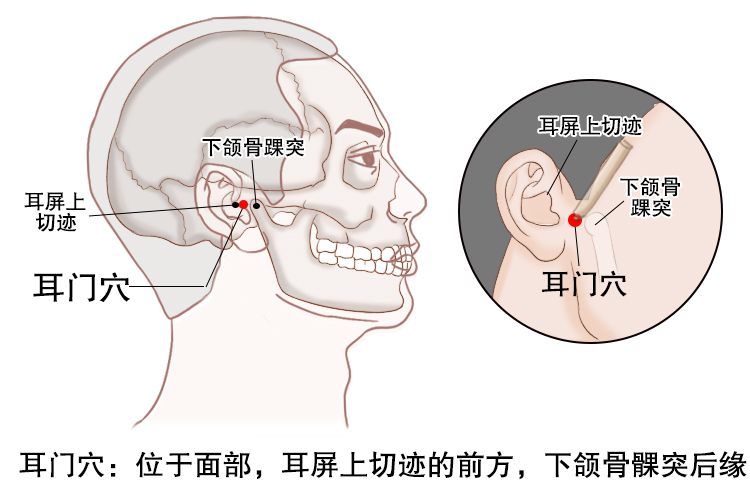 中耳炎艾灸示意图