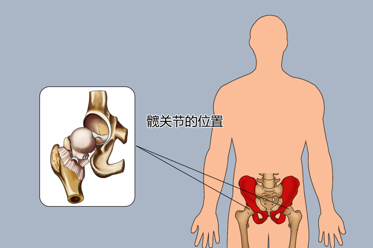 髋关节的位置图