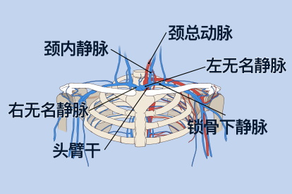 左右无名静脉解剖图