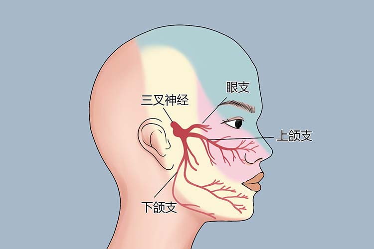 神经痛会引起哪些部位疼