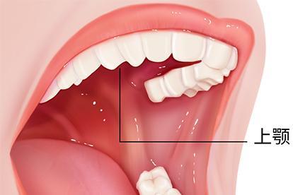 上颚位置图