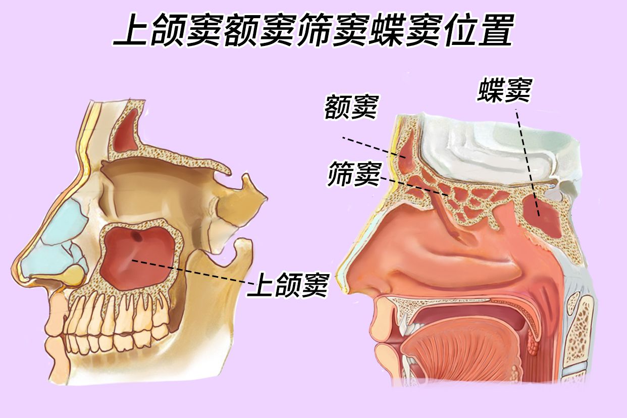 上颌窦额窦筛窦蝶窦位置图片