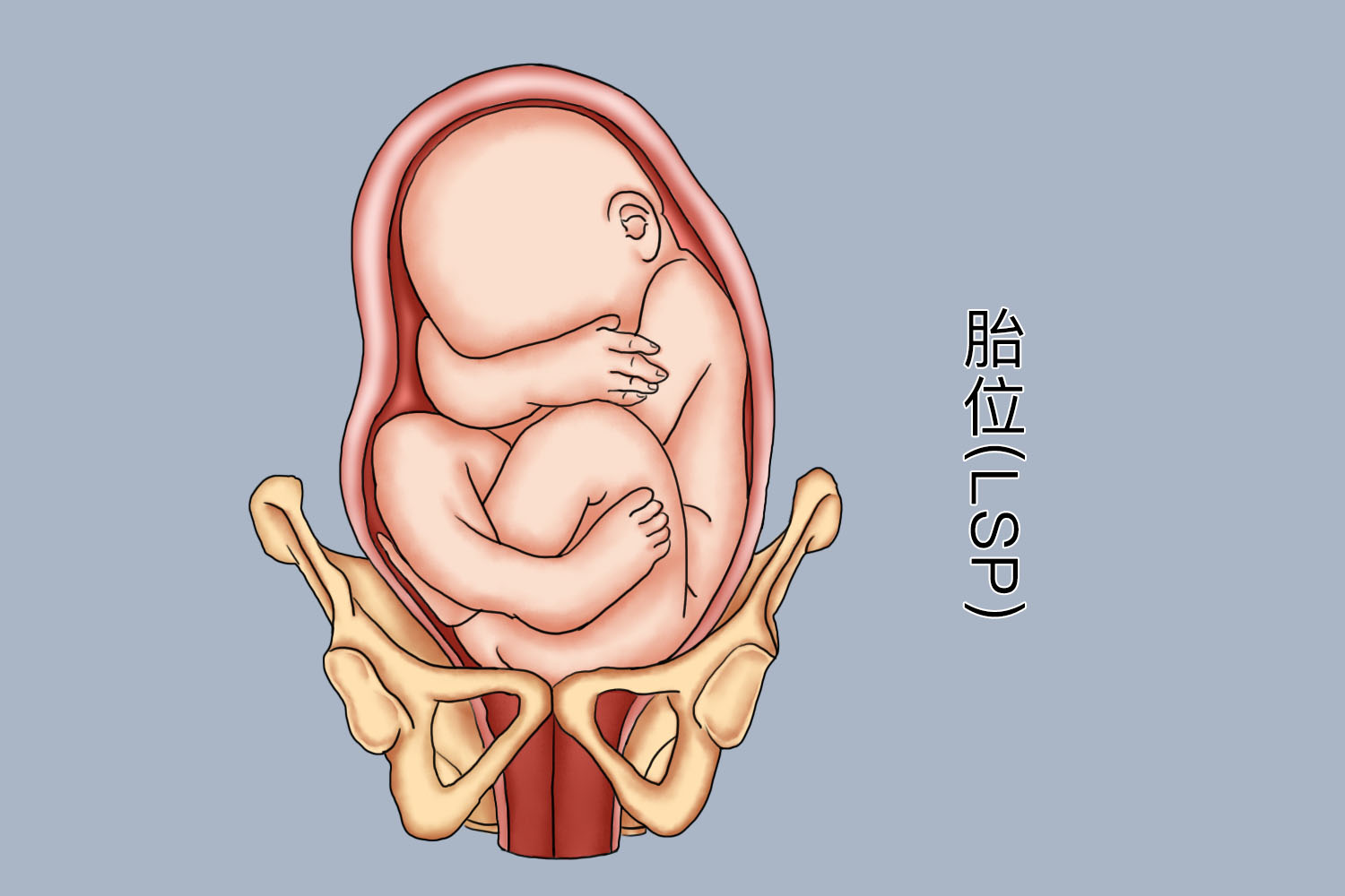 胎位LSP是什么胎位图片