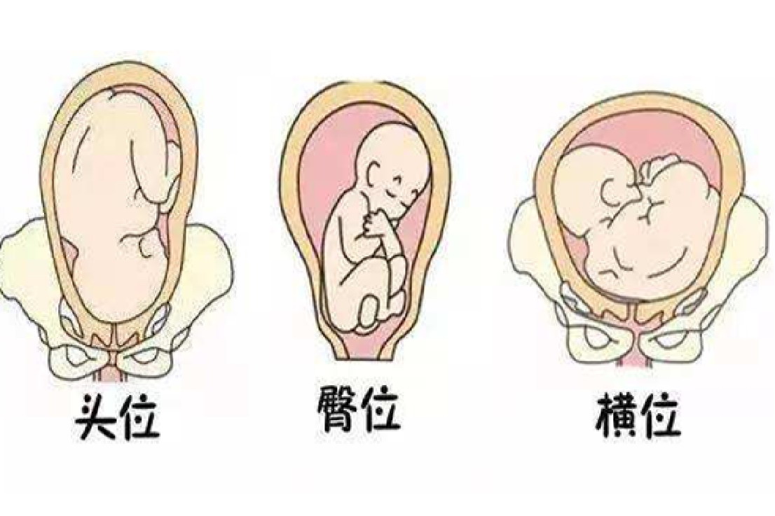 孕晚期头位胎儿图