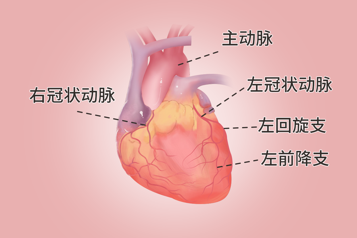 冠状动脉和主动脉图解