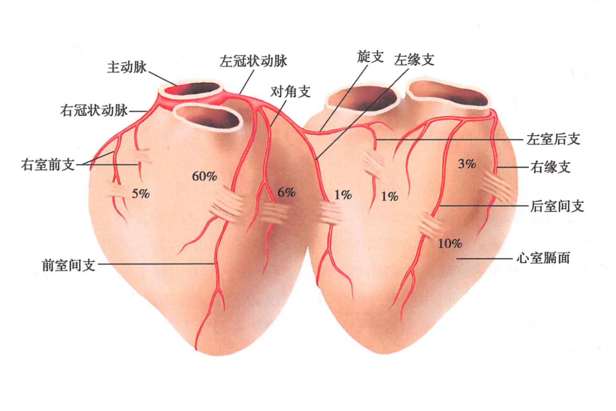 心肌桥分布示意图